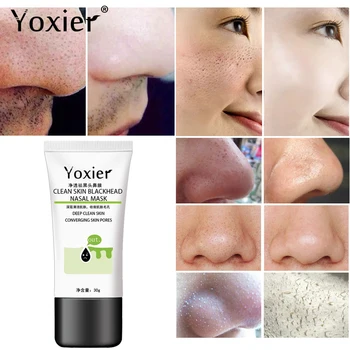 Купи 2 Получавате 1 Подарък Yoxier Acne Treatment Set Face Cream Remove Blackhead Mask Shrink Pores Cleanser Oil Control Грижа За Кожата
