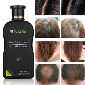 200 мл Dexe Hair Shampoo Set Anti-hair Loss Chinese Herbal Hair Growth Product Prevent Hair Treatment for Men & Women